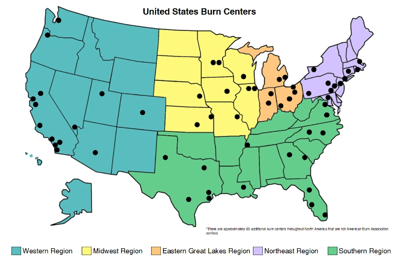 Burn United States