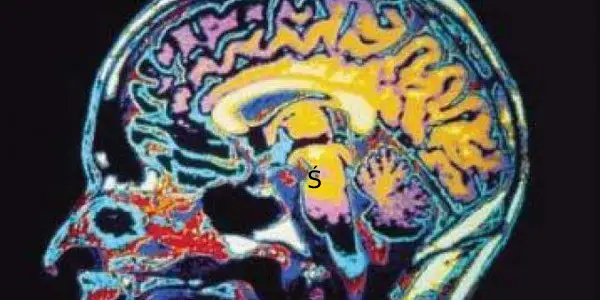 Brain Injury