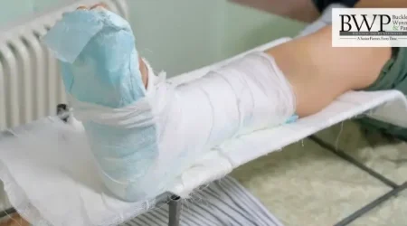Injured at a Connecticut Hotel