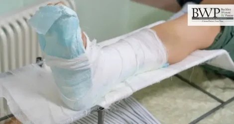 Injured at a Connecticut Hotel