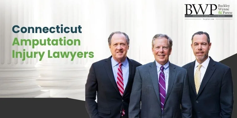 best amputation injury lawyer in connecticut